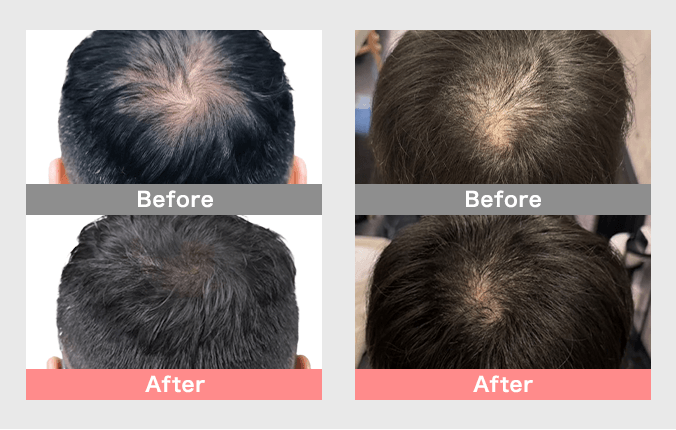 ヘアスカルプメイク施術のビフォーアフター画像